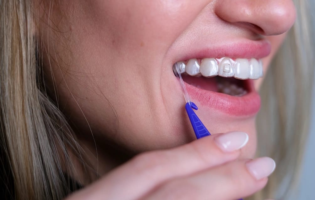 correções funcionais