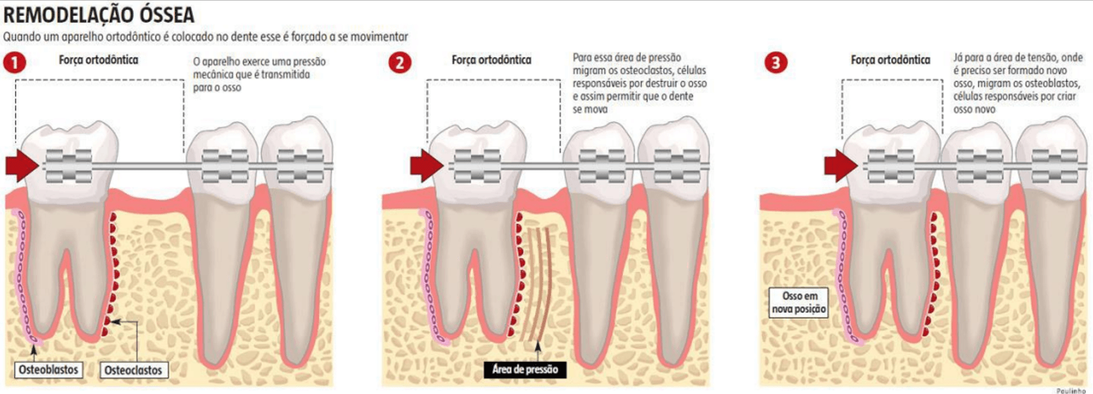 Tabela de fatores influenciadores do tempo de troca