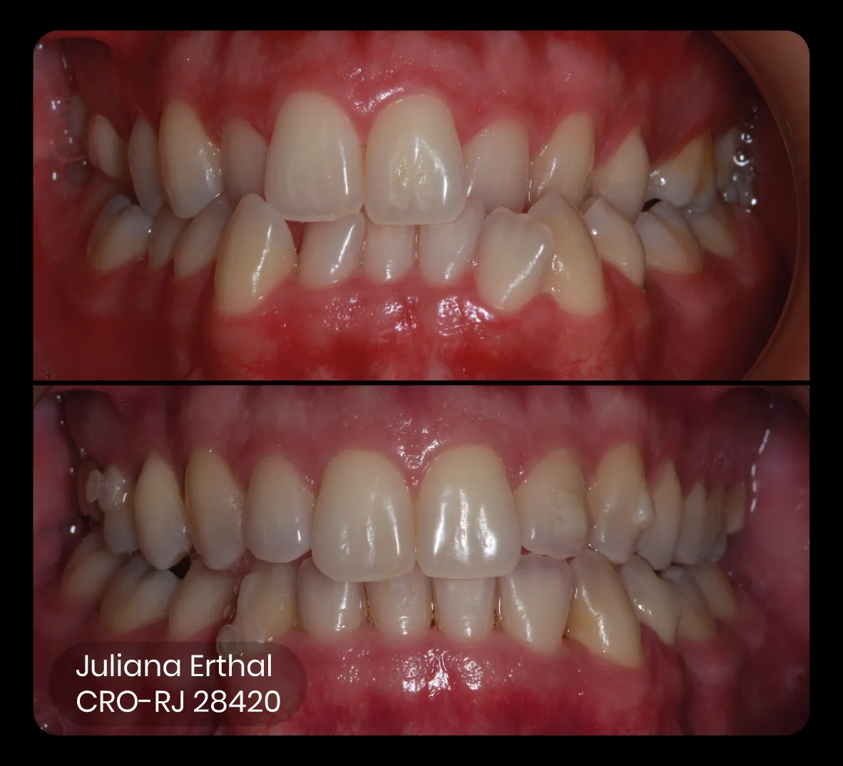 embalagem do plano ez 60