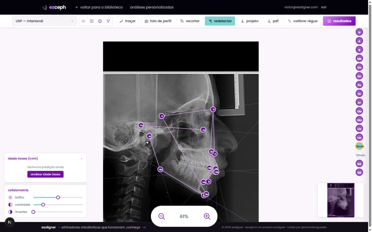 tela do ezceph mostrando os pontos cefalométricos marcados automaticamente sobre uma radiografia lateral