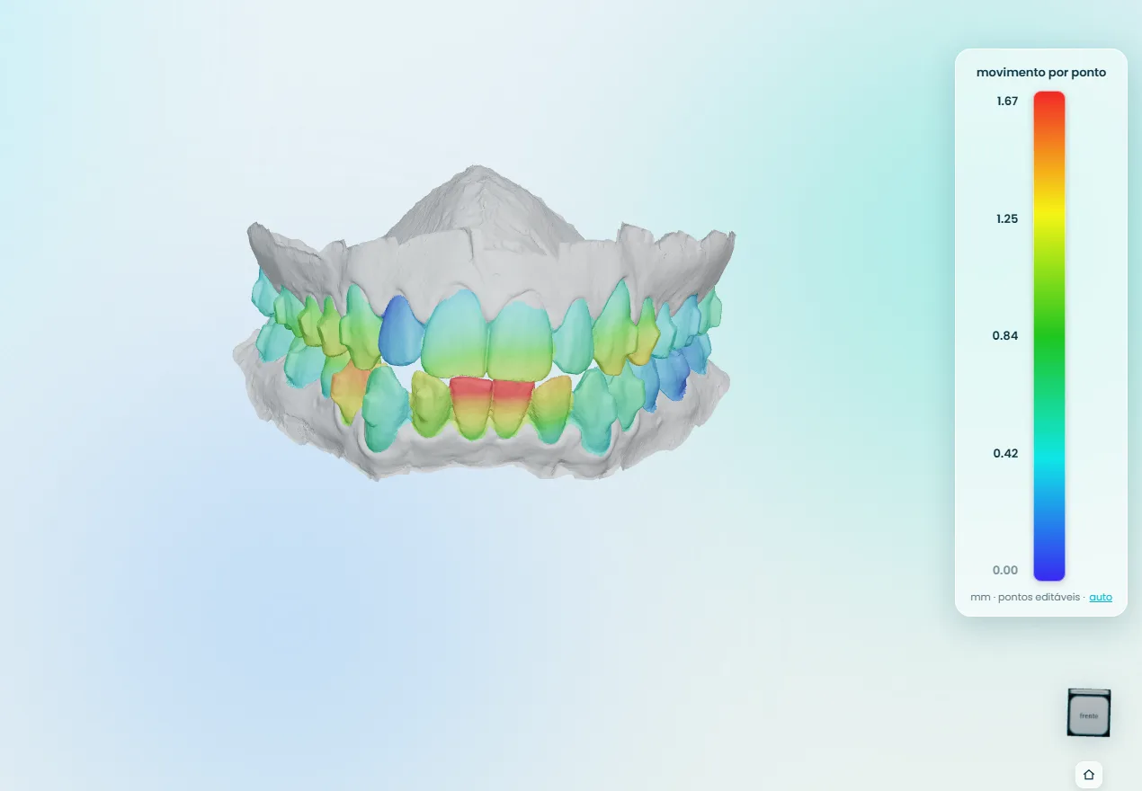 mapa de calor do mov.map: arcada 3D com cada dente colorido pelo quanto se moveu, de azul (sem movimento) a vermelho, com escala em milímetros