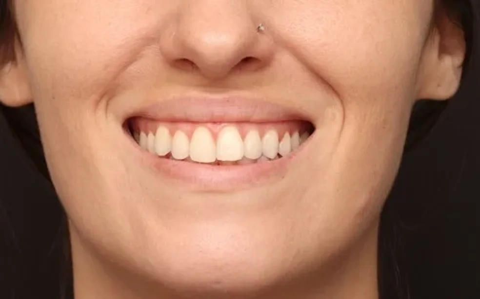 foto original do paciente