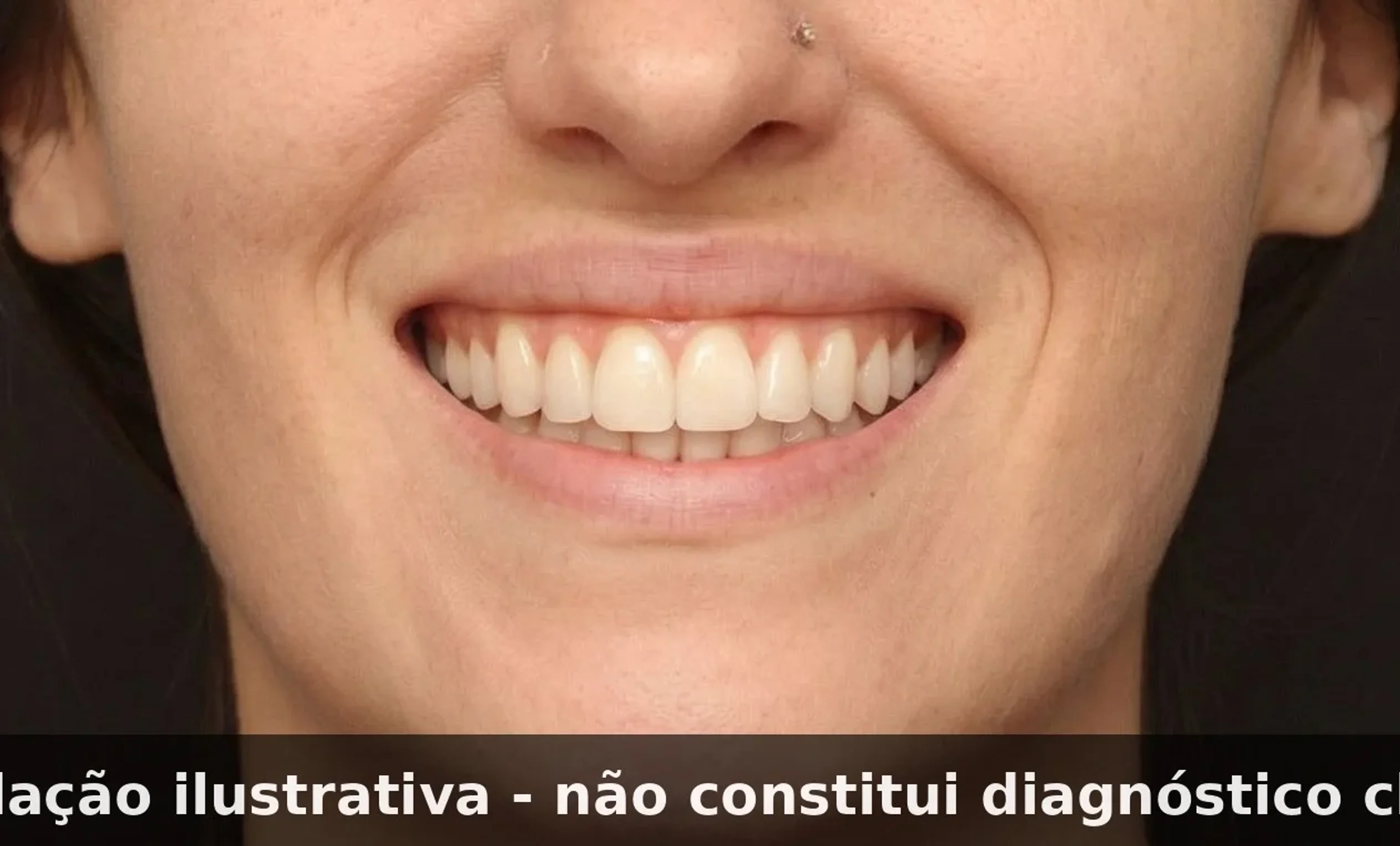 resultado da simulação de sorriso