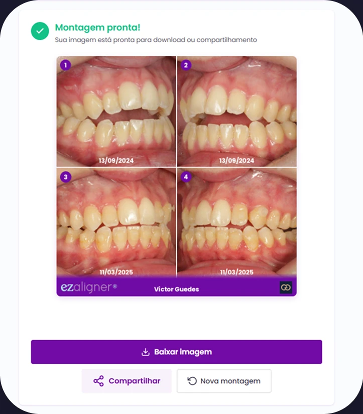 exemplo de montagem de antes e depois gerada pela ferramenta de templates para instagram da ezaligner